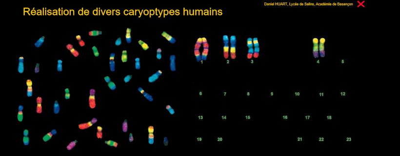 Caryotypes Au Collège – SVT – Académie De Besançon